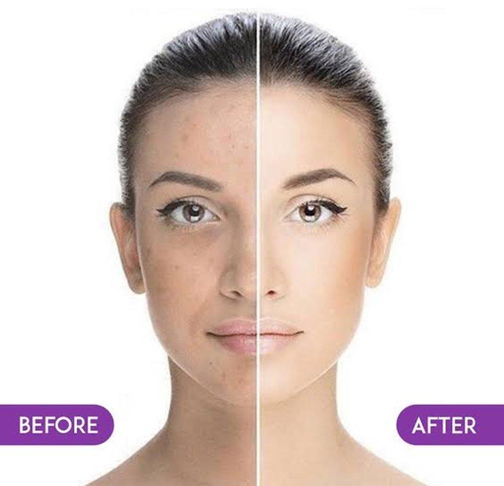 Wonder face sheet mask pack of 2